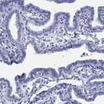 ADAD2 Antibody in Immunohistochemistry (Paraffin) (IHC (P))