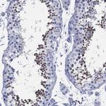 ADAD2 Antibody in Immunohistochemistry (Paraffin) (IHC (P))