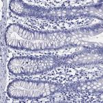 SLC9A11 Antibody in Immunohistochemistry (Paraffin) (IHC (P))