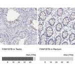 FAM187B Polyclonal Antibody