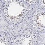 FAM187B Antibody in Immunohistochemistry (Paraffin) (IHC (P))