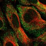 CRYGA Polyclonal Antibody