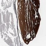 CRYGA Antibody in Immunohistochemistry (Paraffin) (IHC (P))