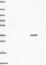 QPRT Antibody in Western Blot (WB)