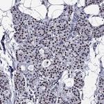 ZNF154 Antibody in Immunohistochemistry (Paraffin) (IHC (P))