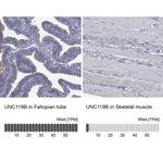 UNC119B Antibody in Immunohistochemistry (Paraffin) (IHC (P))