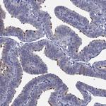 UNC119B Antibody in Immunohistochemistry (Paraffin) (IHC (P))