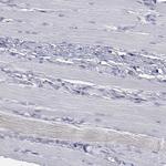 UNC119B Antibody in Immunohistochemistry (Paraffin) (IHC (P))