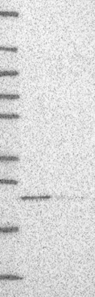 UNC119B Antibody in Western Blot (WB)