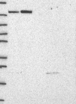 TTC21B Antibody in Western Blot (WB)