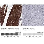 EHBP1L1 Polyclonal Antibody