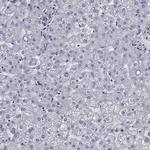 EHBP1L1 Antibody in Immunohistochemistry (Paraffin) (IHC (P))