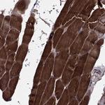EHBP1L1 Antibody in Immunohistochemistry (Paraffin) (IHC (P))