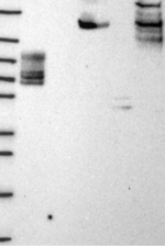 EHBP1L1 Antibody in Western Blot (WB)