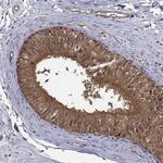 PSMG4 Polyclonal Antibody