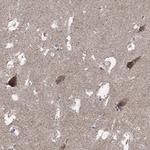 C9orf85 Antibody in Immunohistochemistry (Paraffin) (IHC (P))