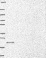 C9orf85 Antibody in Western Blot (WB)