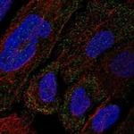 COL12A1 Antibody in Immunocytochemistry (ICC/IF)