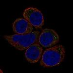 IGSF10 Polyclonal Antibody