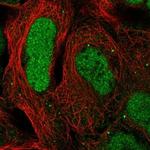 CAMTA2 Polyclonal Antibody