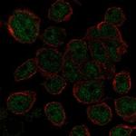 AHDC1 Antibody in Immunocytochemistry (ICC/IF)