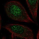 CHST7 Polyclonal Antibody