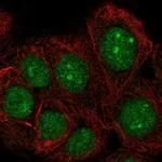 TAF1D Antibody in Immunocytochemistry (ICC/IF)