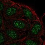 FAM193B Polyclonal Antibody