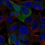 AMDHD1 Polyclonal Antibody