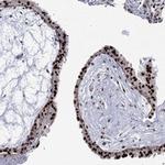 GSE1 Antibody in Immunohistochemistry (Paraffin) (IHC (P))