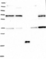 GSE1 Antibody in Western Blot (WB)
