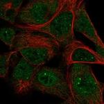 SKIV2L Polyclonal Antibody