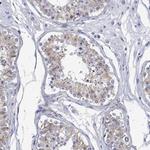 ANKMY1 Antibody in Immunohistochemistry (Paraffin) (IHC (P))
