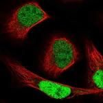 NCAPG2 Antibody in Immunocytochemistry (ICC/IF)