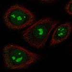 TAS2R5 Polyclonal Antibody