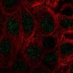 COMMD10 Antibody in Immunocytochemistry (ICC/IF)