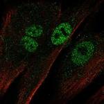 EBF2 Polyclonal Antibody