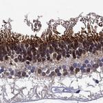 Spectrin beta-5 Antibody in Immunohistochemistry (Paraffin) (IHC (P))