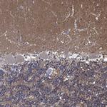 ZNF671 Antibody in Immunohistochemistry (Paraffin) (IHC (P))