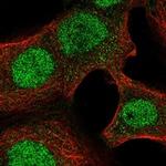 NAA40 Polyclonal Antibody