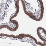 TMTC4 Polyclonal Antibody