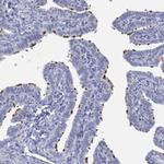 PPIL6 Antibody in Immunohistochemistry (Paraffin) (IHC (P))