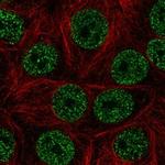 ZBTB9 Polyclonal Antibody