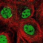 PCGF5 Polyclonal Antibody