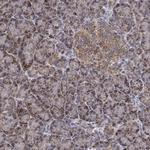 GPSM1 Antibody in Immunohistochemistry (Paraffin) (IHC (P))