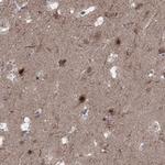 PLCL2 Polyclonal Antibody