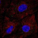 EMP3 Polyclonal Antibody
