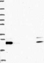 GLTP Antibody in Western Blot (WB)