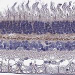EGFLAM Antibody in Immunohistochemistry (Paraffin) (IHC (P))
