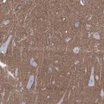 SHISA4 Polyclonal Antibody